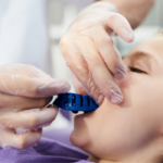 Do's and Don'ts of Post-Tooth Extraction Care